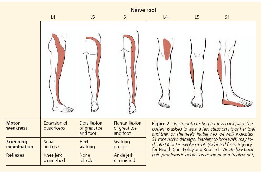 Back Pain To Leg Pain And Weakness